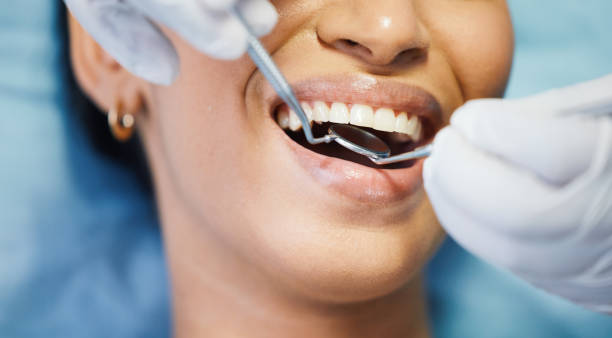 Best Knocked-Out Tooth Emergency  in Carrollton, IL